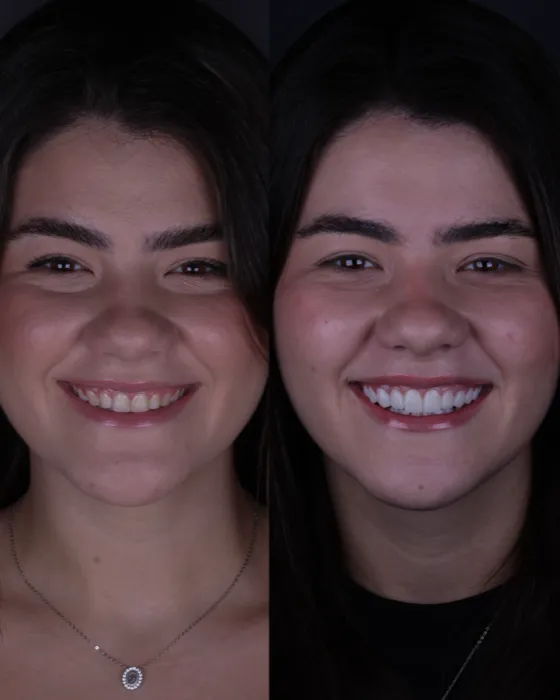Entrega do sorriso