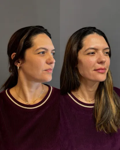 Estética e harmonização
